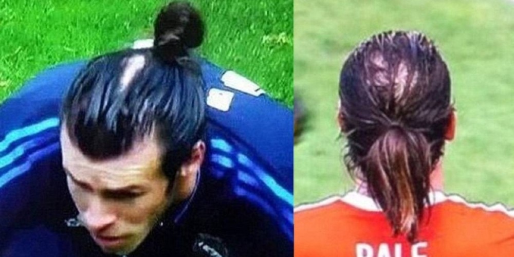 Gareth Bale se har&iacute;a un injerto capilar por motivos deportivos