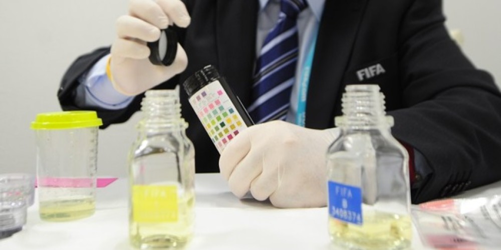 La FIFA comenz&oacute; a aplicar el perfil biol&oacute;gico en la Copa Confederaciones