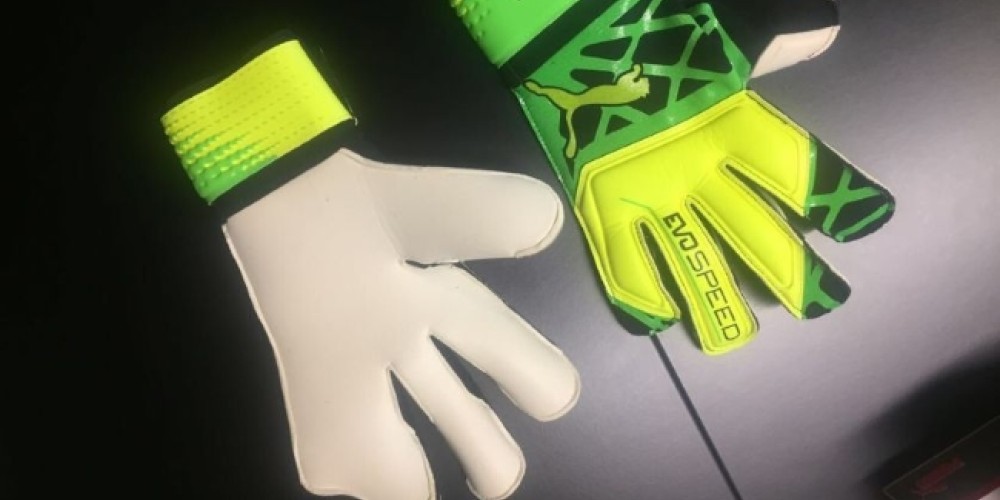 La firma que viste a Muslera le dise&ntilde;&oacute; guantes especiales por su lesi&oacute;n
