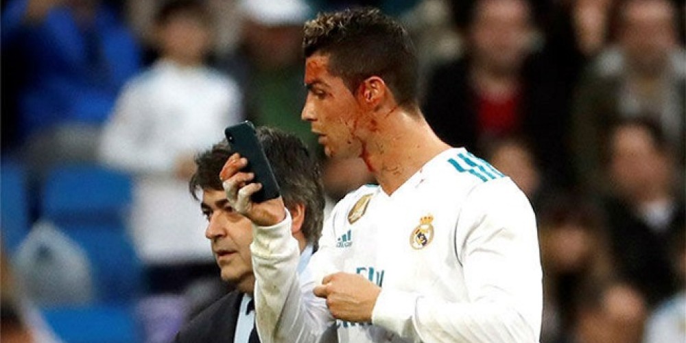 Cristiano Ronaldo reaccionó curiosamente tras recibir un fuerte golpe