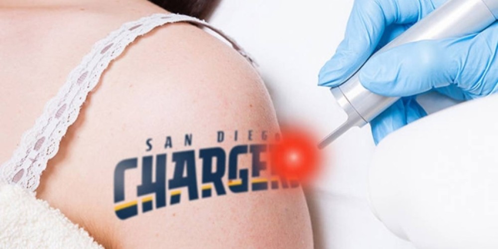 La historia de la empresa que quitará tatuajes gratis por la 'desaparición' de un club