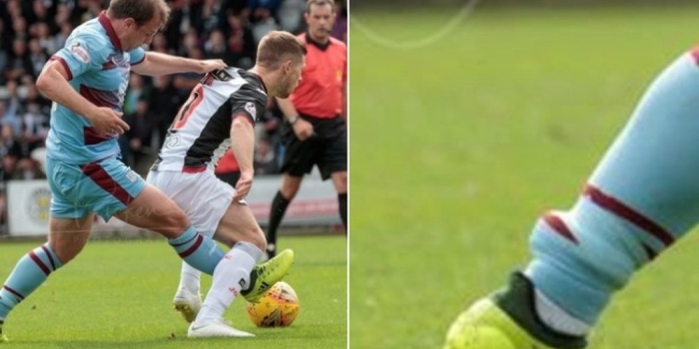 En Escocia un futbolista jug&oacute; con tobillera de rastreo y en libertad condicional