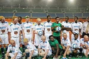 La historia del equipo de albinos que salv&oacute; vidas en Tanzania 