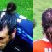 Gareth Bale se har&iacute;a un injerto capilar por motivos deportivos