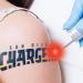 La historia de la empresa que quitar&aacute; tatuajes gratis por la 'desaparici&oacute;n' de un club
